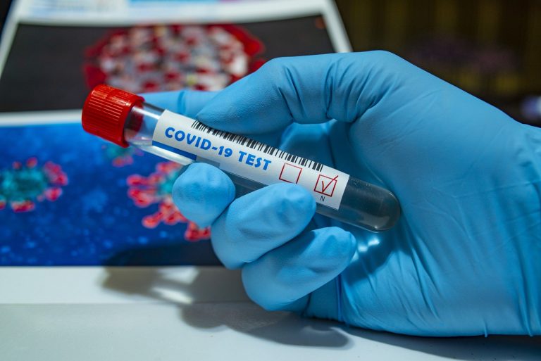 Пробирка с тестом на коронавирус
