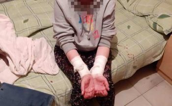 Женщина вскрыла себе вены