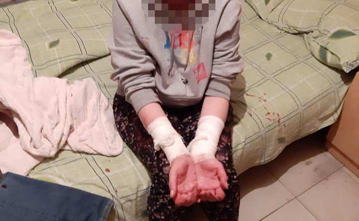 В Киеве юноша вскрыл себе вены и прислал девушке кровавое фото