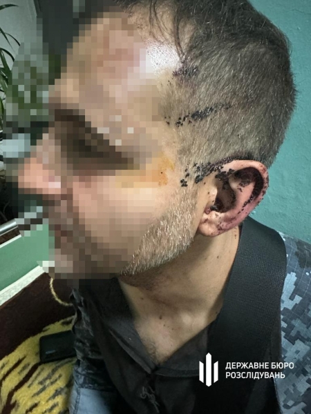 В Одесской области ответственный по воинской части избил военнослужащего